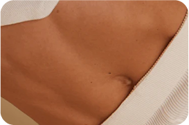 Slimbiotics® (Postbiotic)